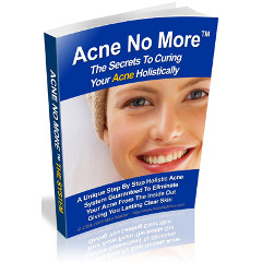 acne natural treatment